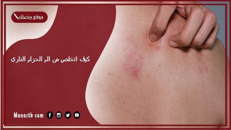 كيف اتخلص من الم الحزام الناري 1447 أسرع طريقة لعلاج الحزام الناري