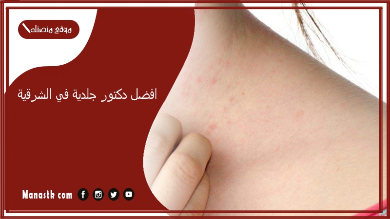 افضل دكتور جلدية في الشرقية