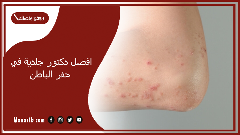 افضل دكتور جلدية في حفر الباطن