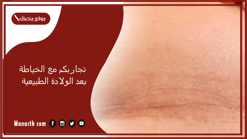 تجربتي مع الخياطة بعد الولادة الطبيعية.. متى تنفك الخياطة بعد الولادة الطبيعية؟