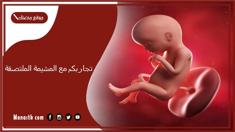 تجاربكم مع المشيمة الملتصقة.. مين كانت عندها المشيمة ملتصقة