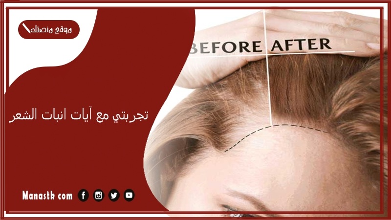 تجربتي مع آيات انبات الشعر.. عالجت شعري بالقران