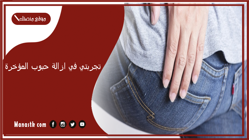 تجربتي في ازالة حبوب المؤخرة.. علاج حبوب المؤخرة نهائيا