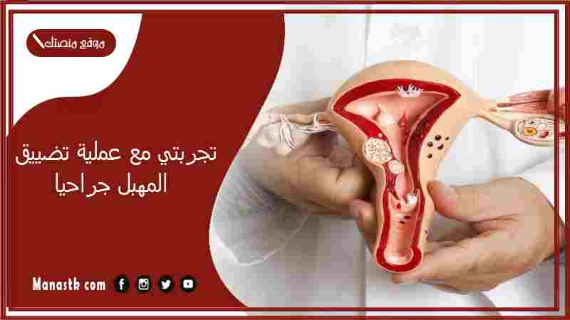 تجربتي مع عملية تضييق المهبل جراحيا.. سويت تضييق وندمت