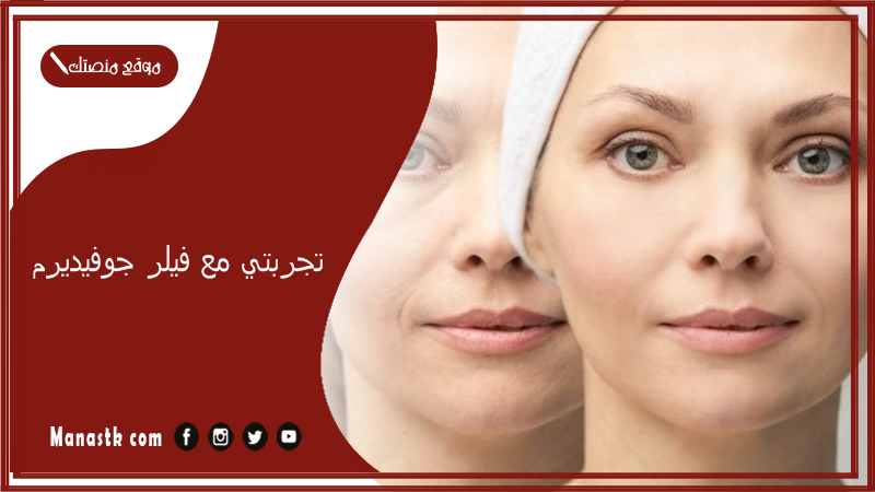 تجربتي مع فيلر جوفيديرم.. مين جربت فيلر جوفيديرم؟