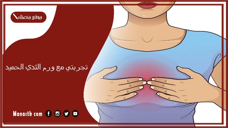 تجربتي مع ورم الثدي الحميد.