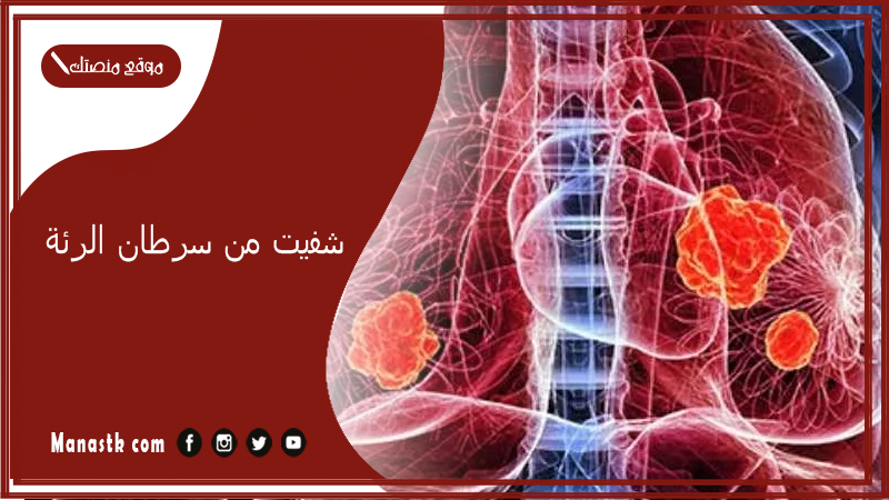 شفيت من سرطان الرئة.. نسبة شفاء سرطان الرئة المرحلة الرابعة