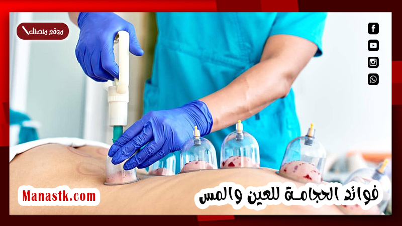 فوائد الحجامة للعين والمس