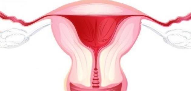 التهابات المهبل