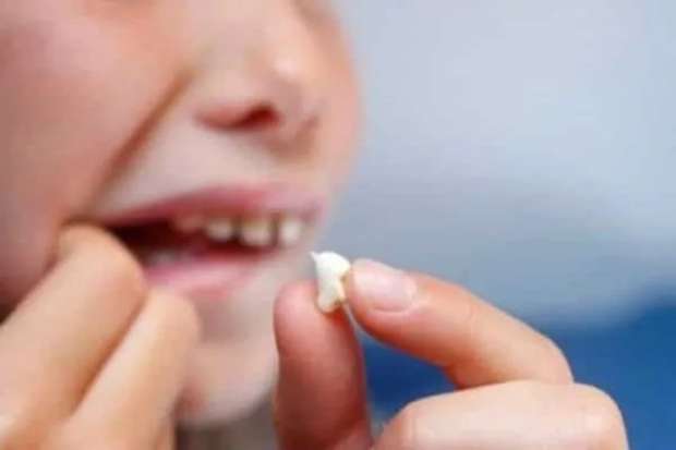 ما تفسير حلم خلع الاسنان لابن سيرين للمتزوجة والعزباء