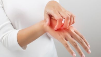 وصفات علاج الحكة الشديدة